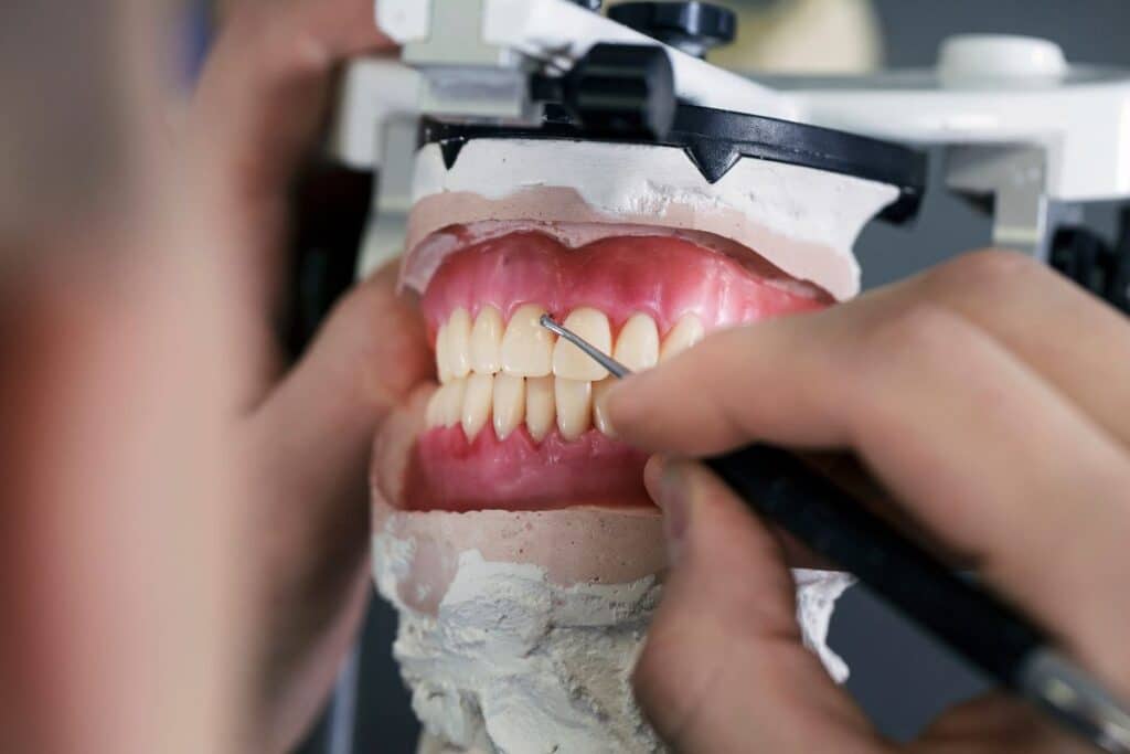 ¿Que-es-un-protesico-dental