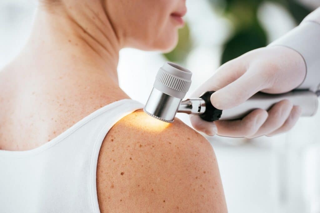 dermatología