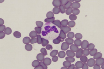 Más Allá de la Garrapata: Diagnóstico y Prevención de la Anaplasmosis Bovina, un Desafío Silencioso en el Campo