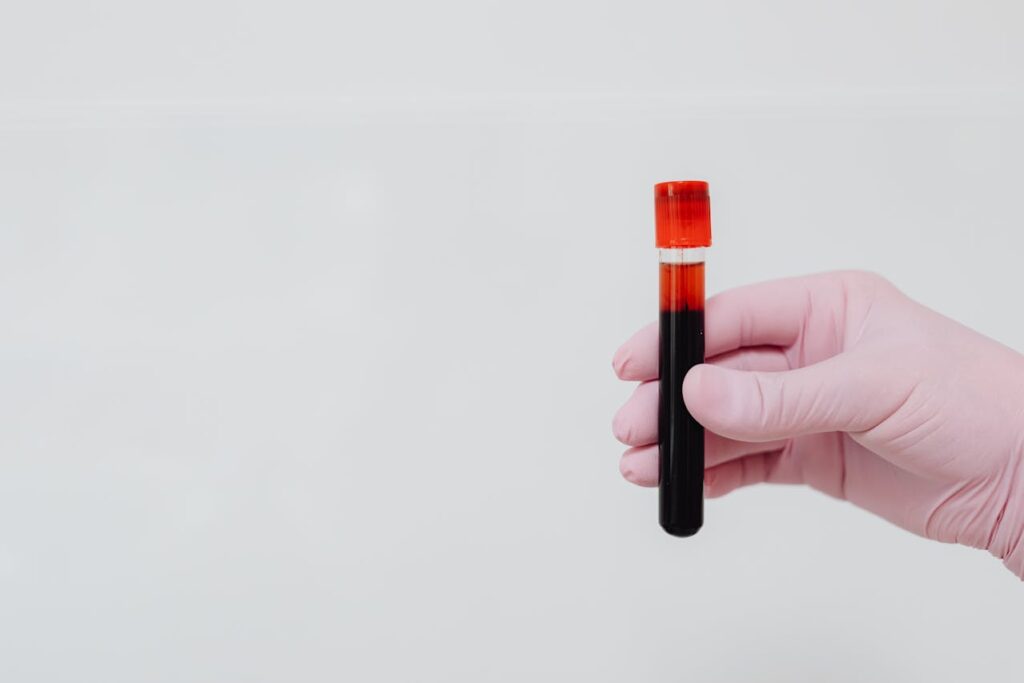 niveles de dióxido de carbono
